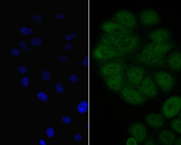 BCL6 Antibody in Immunocytochemistry (ICC/IF)