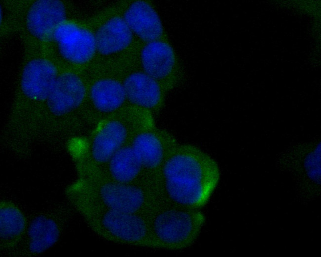 Cytokeratin 20 Antibody in Immunocytochemistry (ICC/IF)