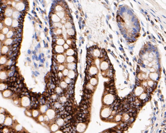 Cytokeratin 20 Antibody in Immunohistochemistry (Paraffin) (IHC (P))