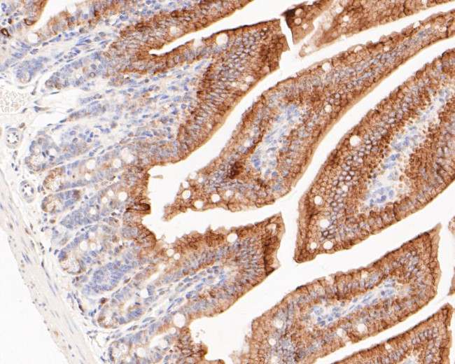 Cytokeratin 20 Antibody in Immunohistochemistry (Paraffin) (IHC (P))