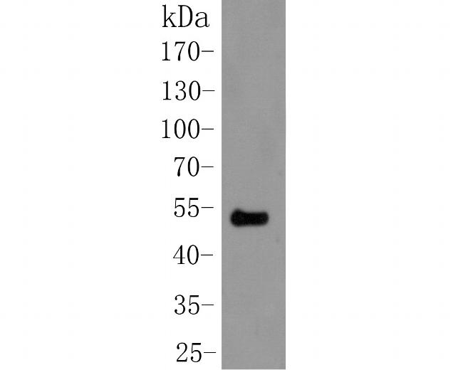 Cytokeratin 20 Antibody in Western Blot (WB)