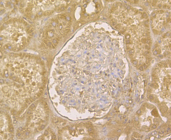 TRADD Antibody in Immunohistochemistry (Paraffin) (IHC (P))