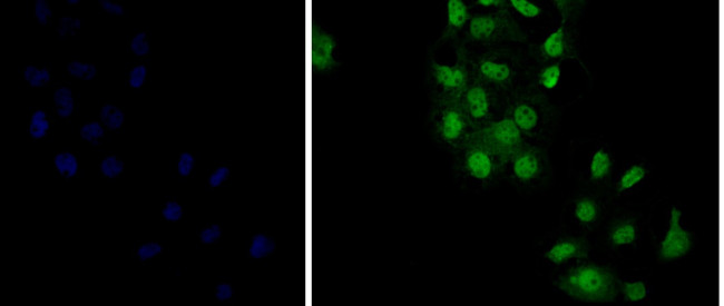 delta Catenin Antibody in Immunocytochemistry (ICC/IF)