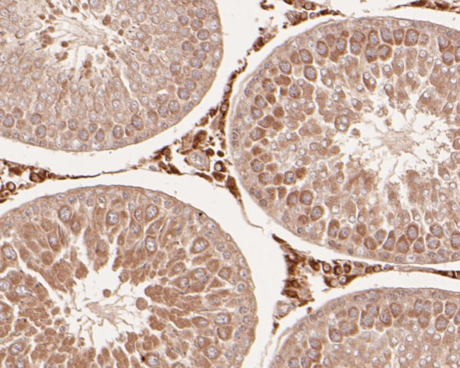 delta Catenin Antibody in Immunohistochemistry (Paraffin) (IHC (P))