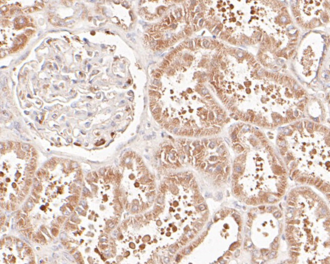 delta Catenin Antibody in Immunohistochemistry (Paraffin) (IHC (P))