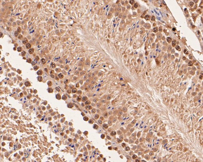 delta Catenin Antibody in Immunohistochemistry (Paraffin) (IHC (P))