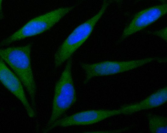 B3GAT1 Antibody in Immunocytochemistry (ICC/IF)