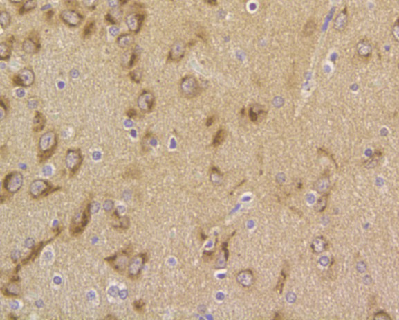 B3GAT1 Antibody in Immunohistochemistry (Paraffin) (IHC (P))