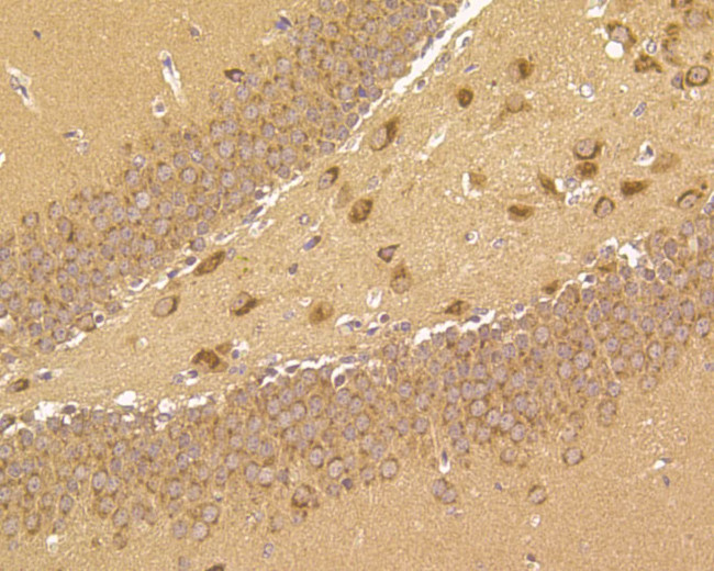 B3GAT1 Antibody in Immunohistochemistry (Paraffin) (IHC (P))