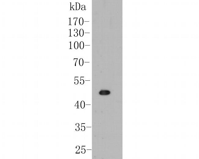 B3GAT1 Antibody in Western Blot (WB)