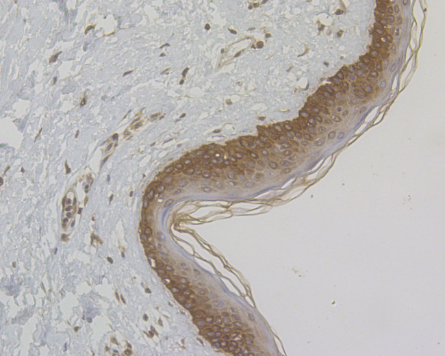 Cytokeratin 5/6 Antibody in Immunohistochemistry (Paraffin) (IHC (P))