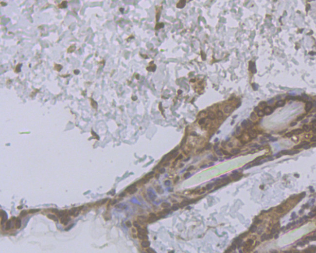 Cytokeratin 5/6 Antibody in Immunohistochemistry (Paraffin) (IHC (P))