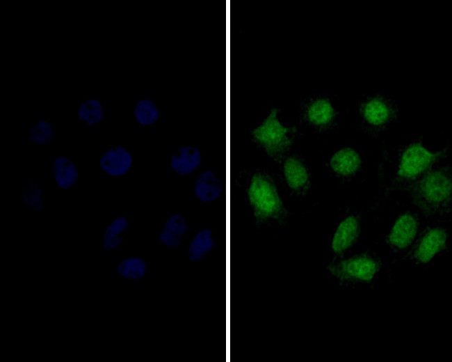 delta Catenin Antibody in Immunocytochemistry (ICC/IF)