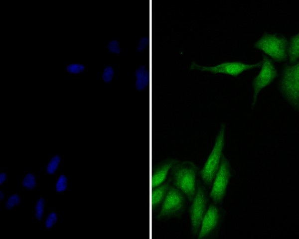 delta Catenin Antibody in Immunocytochemistry (ICC/IF)