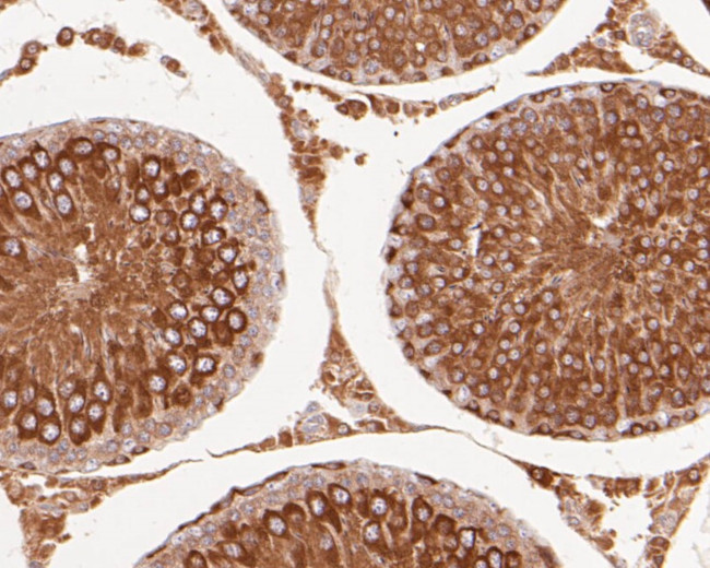 delta Catenin Antibody in Immunohistochemistry (Paraffin) (IHC (P))