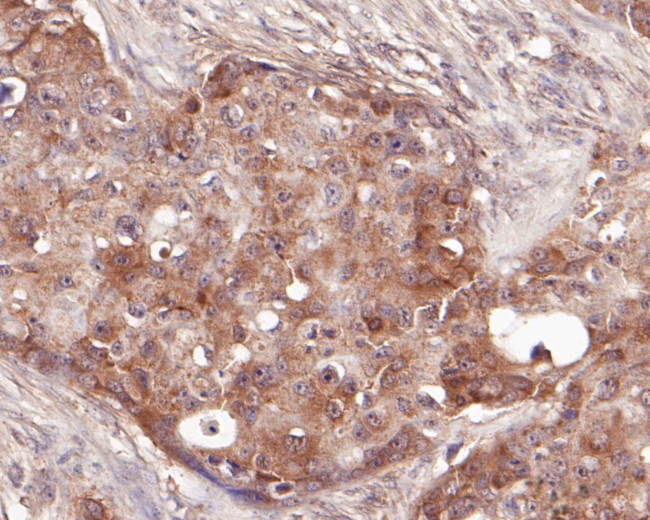 delta Catenin Antibody in Immunohistochemistry (Paraffin) (IHC (P))