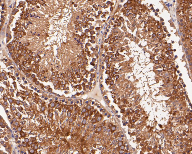 delta Catenin Antibody in Immunohistochemistry (Paraffin) (IHC (P))