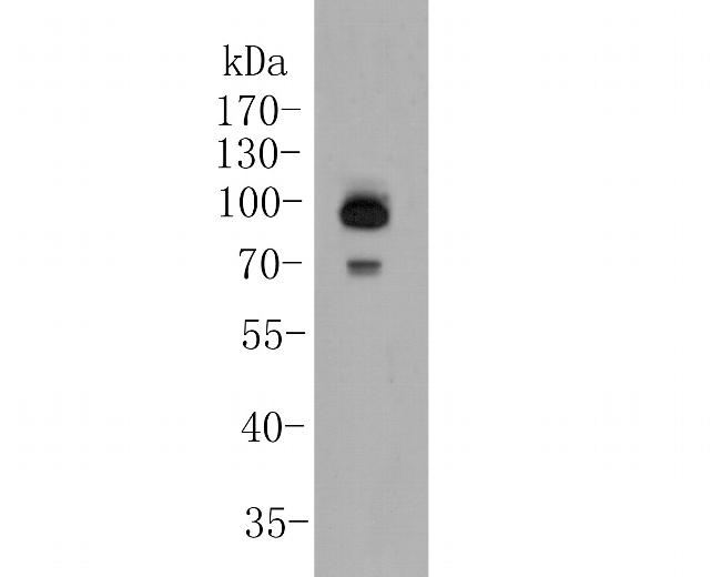 delta Catenin Antibody in Western Blot (WB)