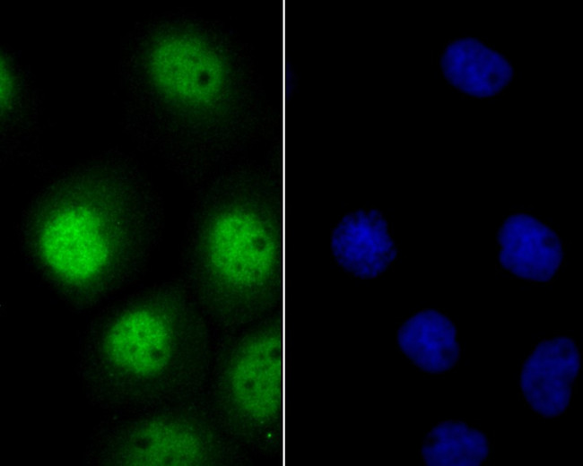 ITCH Antibody in Immunocytochemistry (ICC/IF)