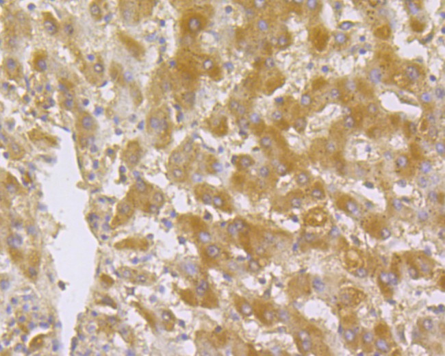 ITCH Antibody in Immunohistochemistry (Paraffin) (IHC (P))