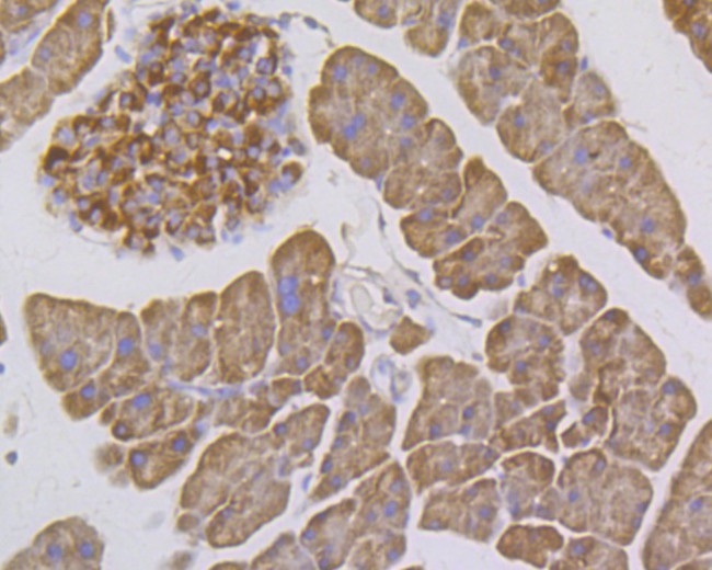 ITCH Antibody in Immunohistochemistry (Paraffin) (IHC (P))