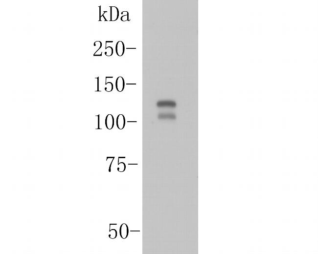 ITCH Antibody in Western Blot (WB)