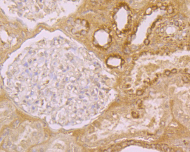 Folate Receptor alpha Antibody in Immunohistochemistry (Paraffin) (IHC (P))