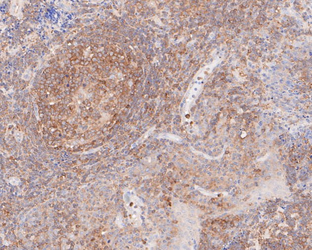 Cytokeratin 20 Antibody in Immunohistochemistry (Paraffin) (IHC (P))