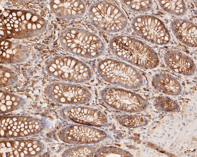 Cytokeratin 20 Antibody in Immunohistochemistry (Paraffin) (IHC (P))