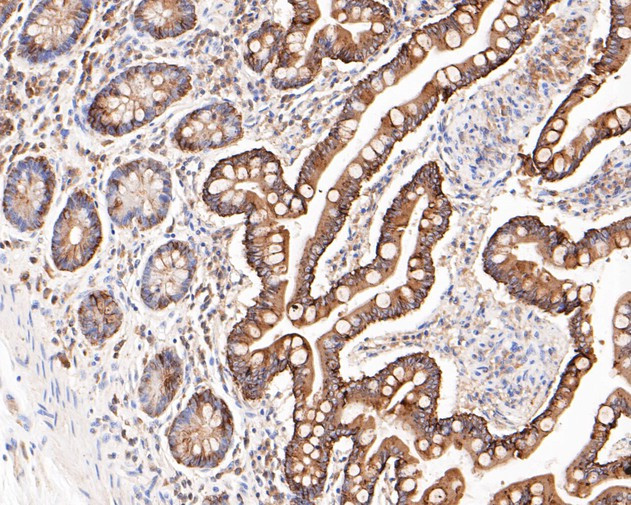 Cytokeratin 20 Antibody in Immunohistochemistry (Paraffin) (IHC (P))