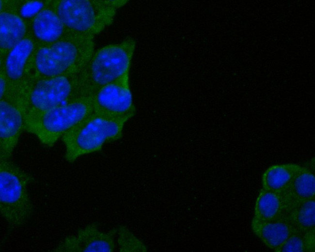 DPP6 Antibody in Immunocytochemistry (ICC/IF)