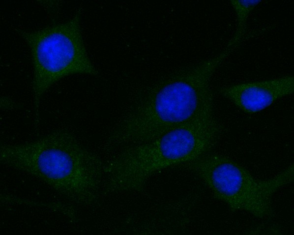 DPP6 Antibody in Immunocytochemistry (ICC/IF)