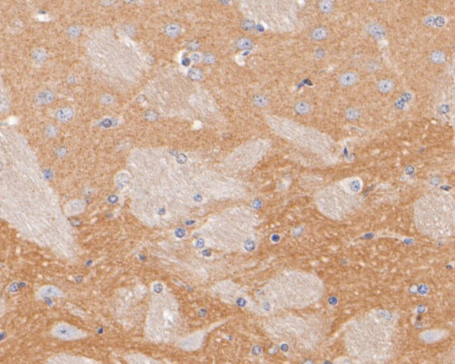 DPP6 Antibody in Immunohistochemistry (Paraffin) (IHC (P))