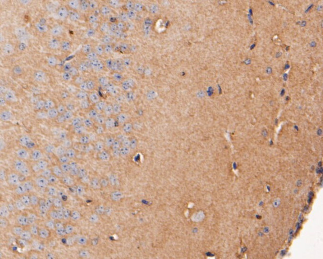 DPP6 Antibody in Immunohistochemistry (Paraffin) (IHC (P))