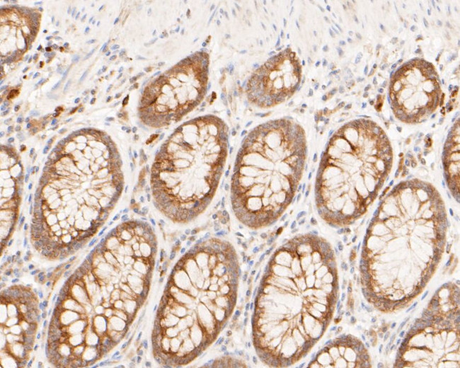 MUC1 Antibody in Immunohistochemistry (Paraffin) (IHC (P))