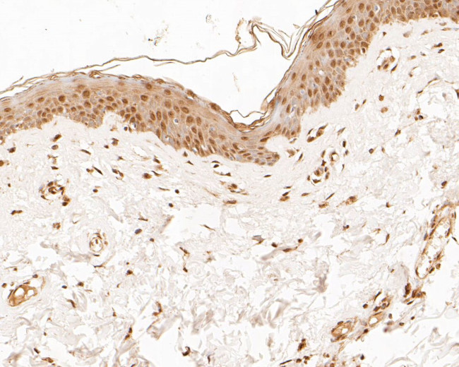 MUC1 Antibody in Immunohistochemistry (Paraffin) (IHC (P))