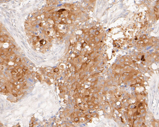 MUC1 Antibody in Immunohistochemistry (Paraffin) (IHC (P))