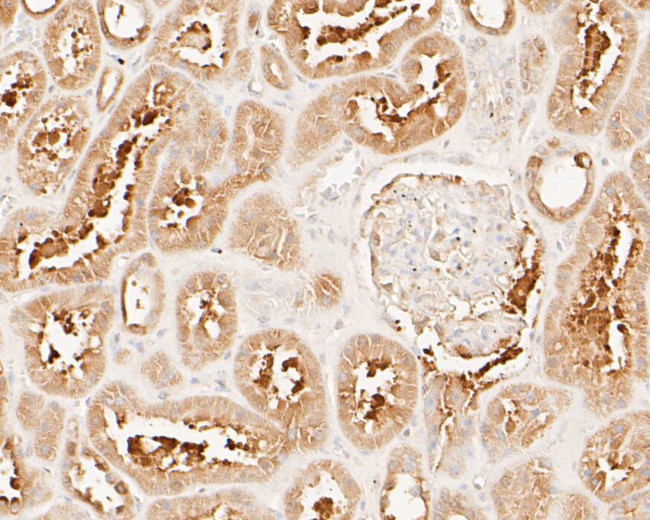 MUC1 Antibody in Immunohistochemistry (Paraffin) (IHC (P))