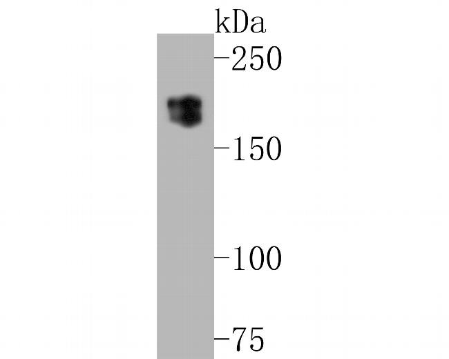 MUC1 Antibody in Western Blot (WB)