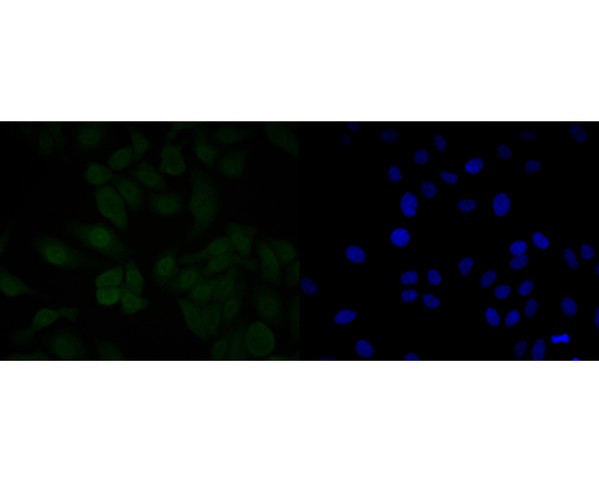 MDM2 Antibody in Immunocytochemistry (ICC/IF)