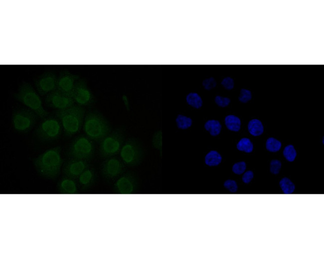 MDM2 Antibody in Immunocytochemistry (ICC/IF)