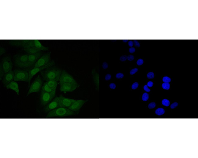 MDM2 Antibody in Immunocytochemistry (ICC/IF)