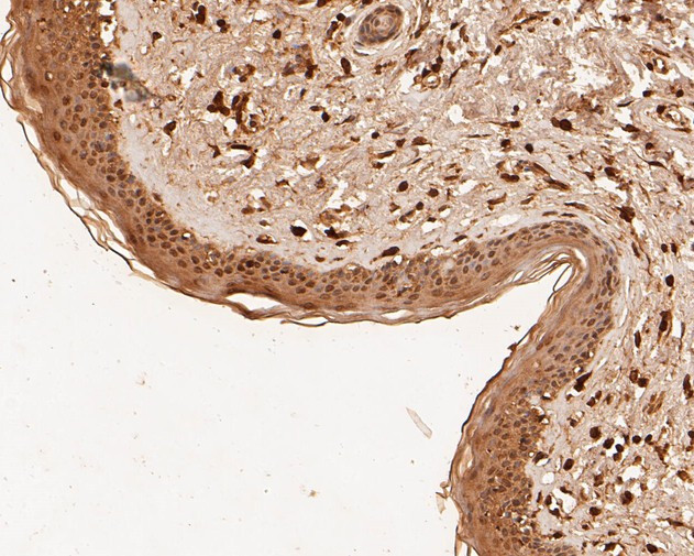 MDM2 Antibody in Immunohistochemistry (Paraffin) (IHC (P))