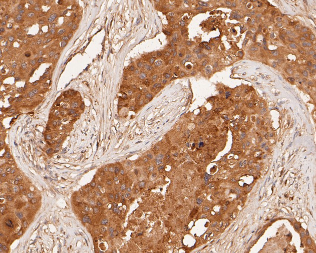 MDM2 Antibody in Immunohistochemistry (Paraffin) (IHC (P))