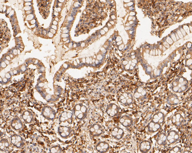 MDM2 Antibody in Immunohistochemistry (Paraffin) (IHC (P))