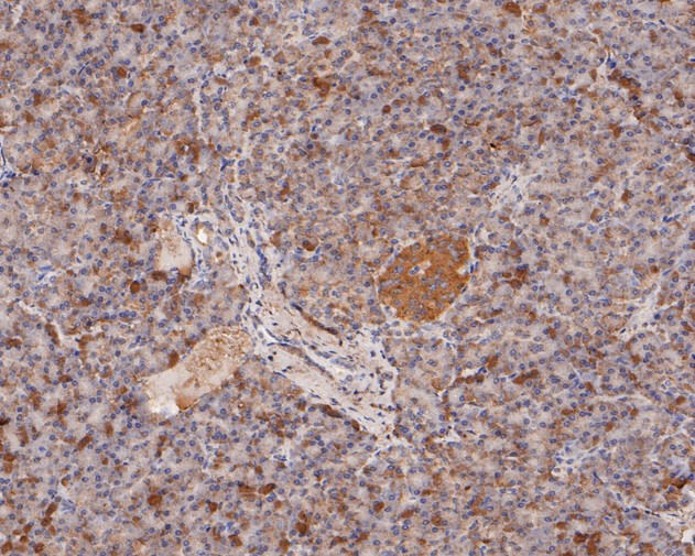 MDM2 Antibody in Immunohistochemistry (Paraffin) (IHC (P))