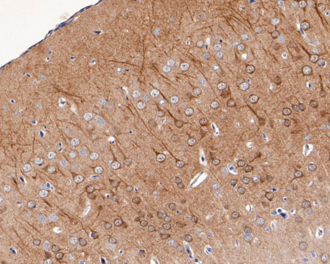 KCNIP1 Antibody in Immunohistochemistry (Paraffin) (IHC (P))