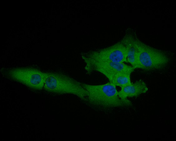 Cardiac Troponin C Antibody in Immunocytochemistry (ICC/IF)