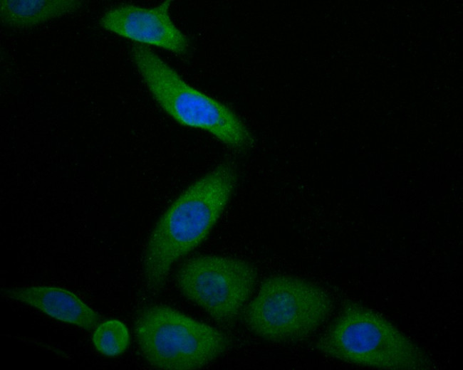 Cardiac Troponin C Antibody in Immunocytochemistry (ICC/IF)