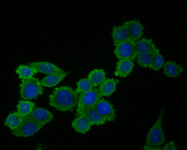 Cardiac Troponin C Antibody in Immunocytochemistry (ICC/IF)